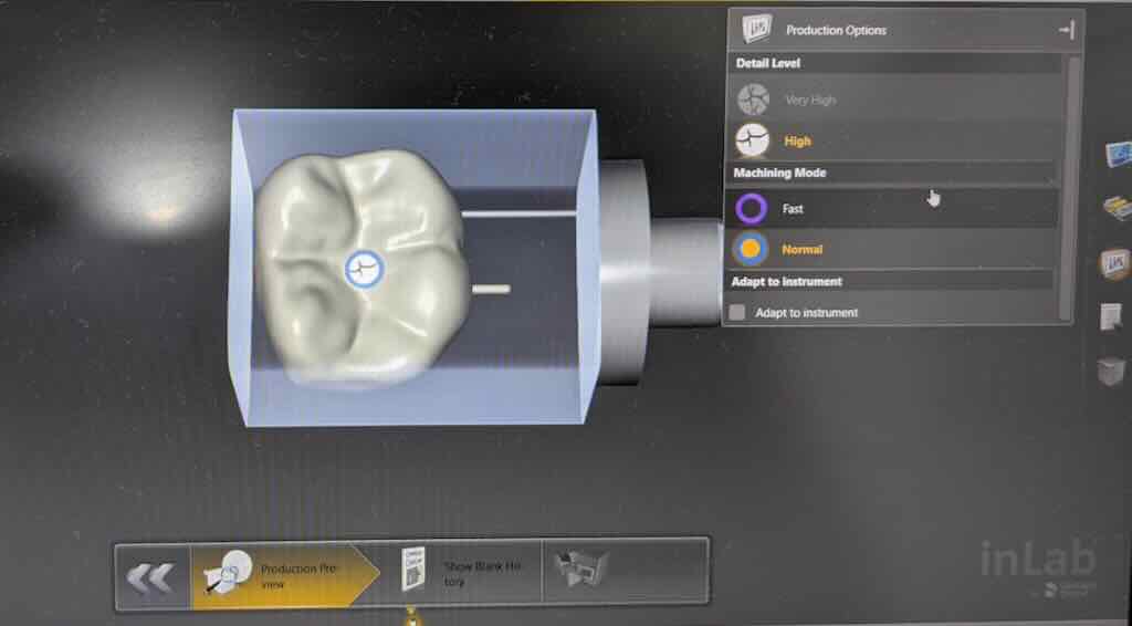 CEREC 1