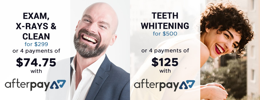 Four payments with AfterPay