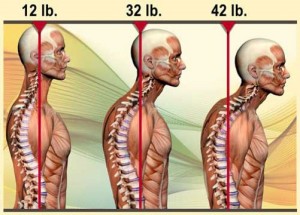 Every inch of Anterior Head Carriage adds 10+ pounds of stress onto the neck.
