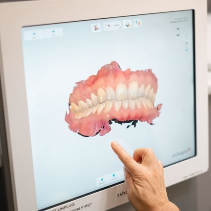 3d model of teeth on computer