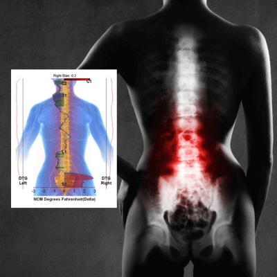 Modern Chiropractic Back Pain
