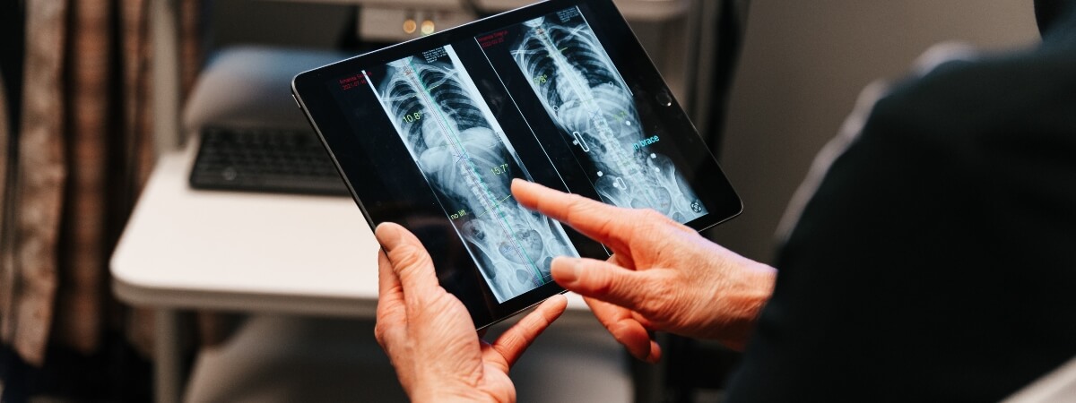 Surrey chiropractor inspecting x-rays