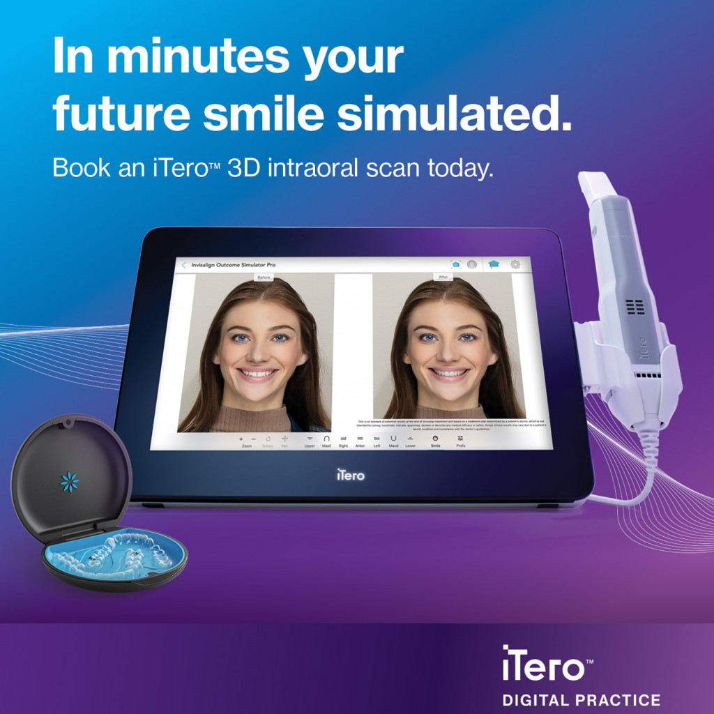 iTero 3D intraoral scanner