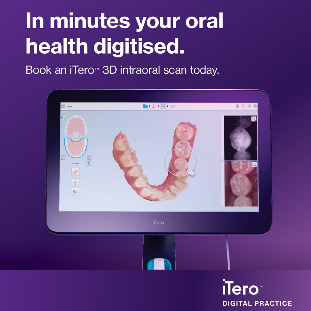 Oral Health Asset iTero