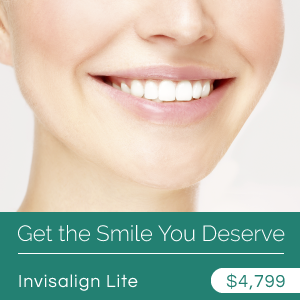 banner-Invisalign-Lite