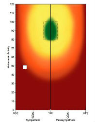 Heart Rate Variability