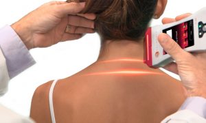 Erchonia Laser Therapy used to treat patient