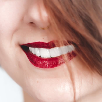 Gleaming smile with same-day teeth whitening