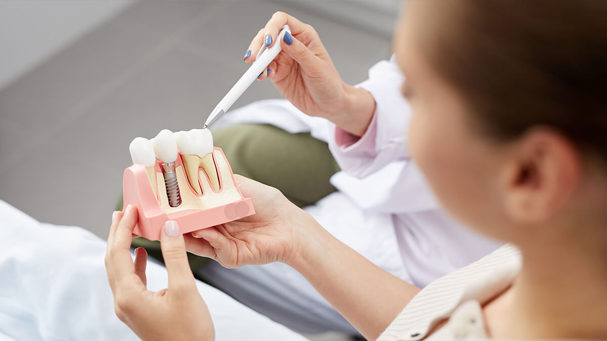 dental-implant-figurine