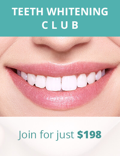 Teeth Whitening Club at Dentist WA Canning Vale