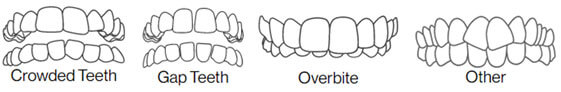 Invisalign Treatment