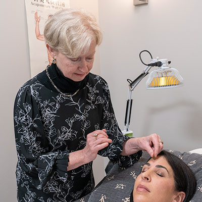 our acupuncturist working on a patient's face