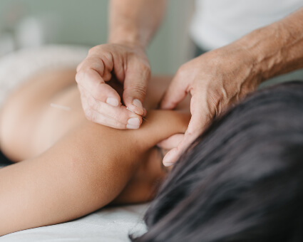 Acupuncture used to treat female patient