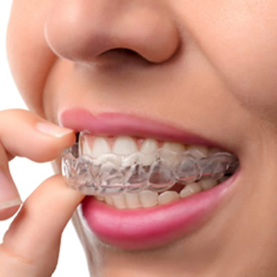 Woman putting Invisalign on