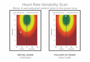 Before and After of HRV