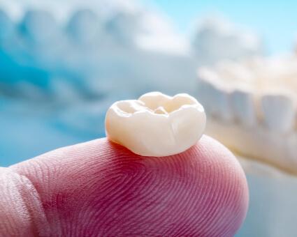 Dental crown