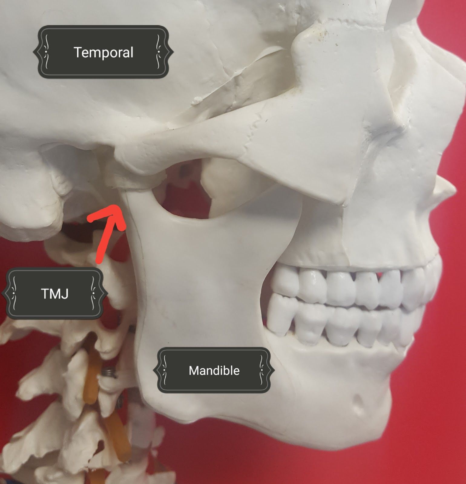 How to prevent jaw locking