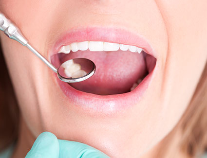 dentist examining teeth