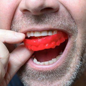 Man using a custom Mouthguard