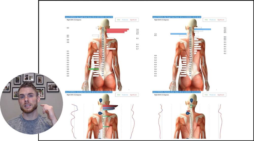 Neurological Scan Review