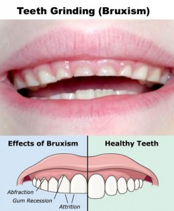 Effects of Chewing Gum on Your Teeth