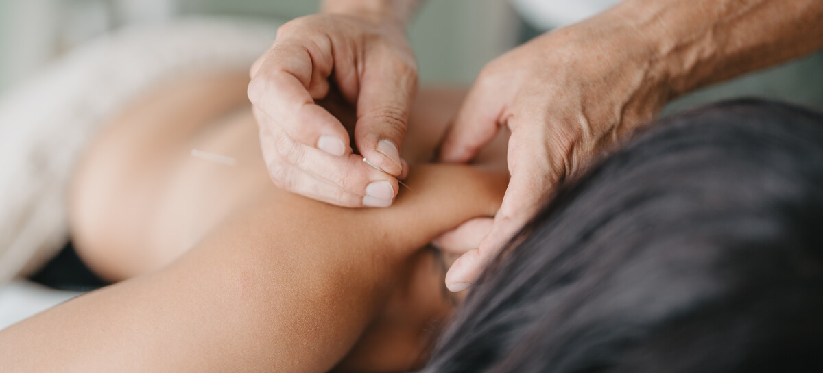 Acupuncture used to treat female patient