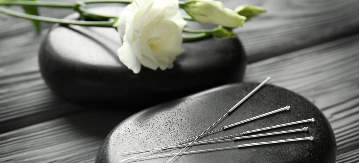 Acupuncture needles and white rose