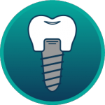 icon-dental-implants-h