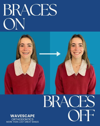 Greta before and after profile