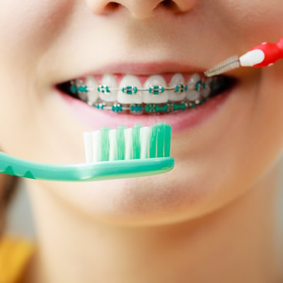 child eith braces brushing teeth