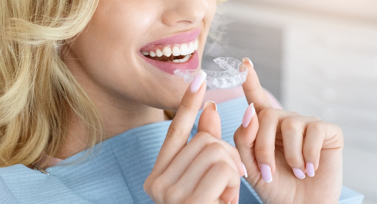 Lady fitting clear aligners