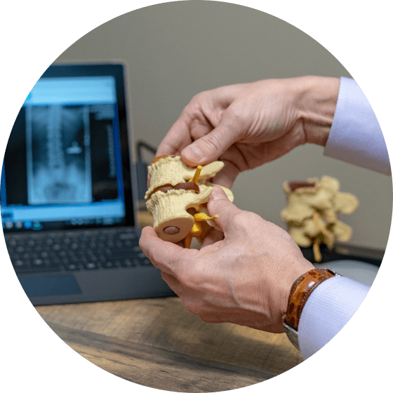 spinal model