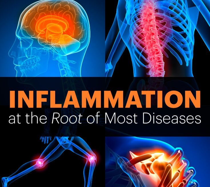 Chronic Inflammation and the Chiropractic Practice