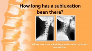 duration of subluxation