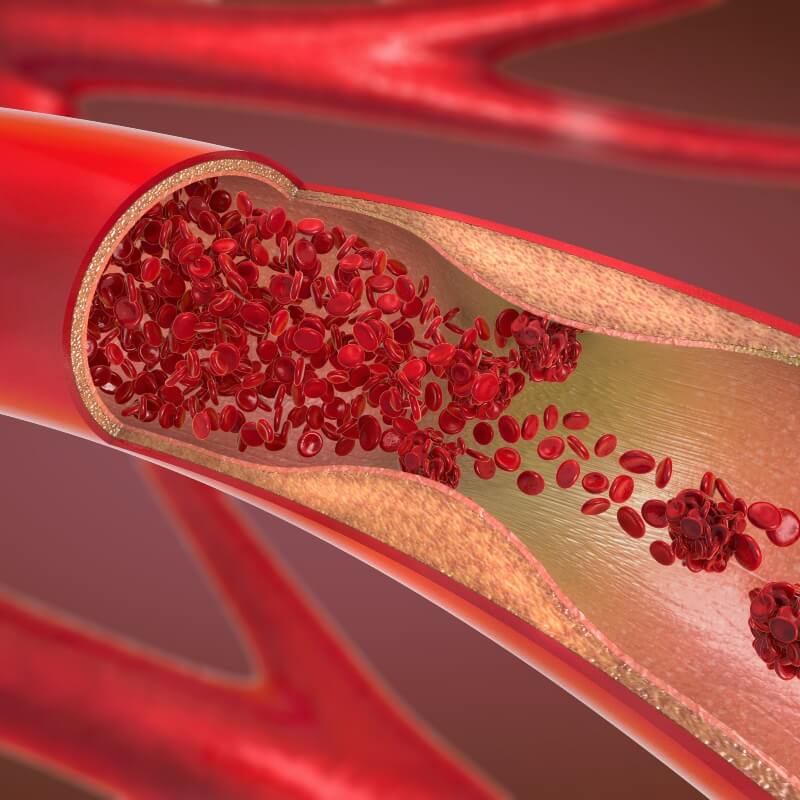 artery illustration