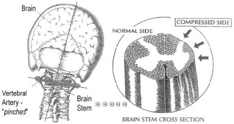 Body and brain illustration