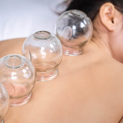 cups on womans back