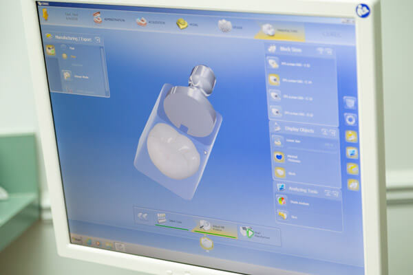 Cerec