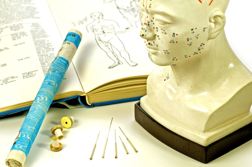 Reasons Why You Should Give Acupuncture a Try