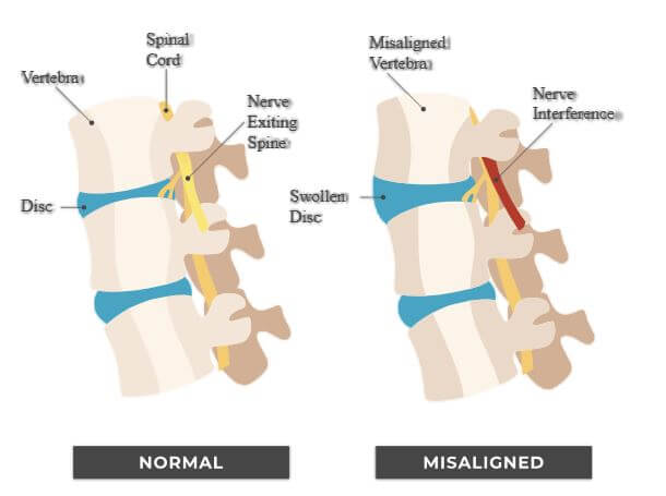 Chiropractic Techniques Help With Back Pain