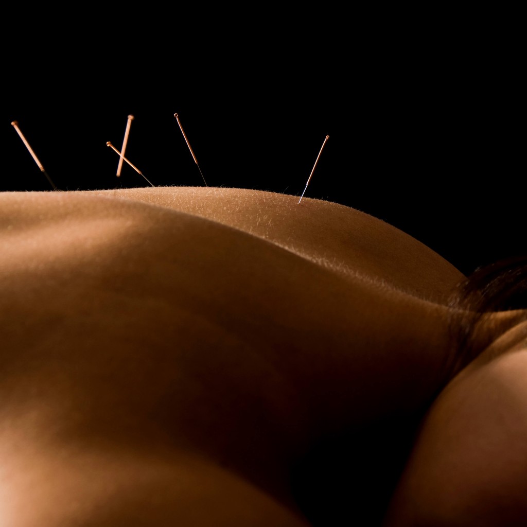 Certified Acupuncturist in {PJ}