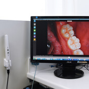 Intra-oral camera at Red Hill Dental