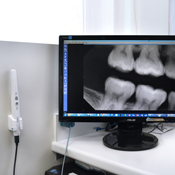 Digital xrays at Red Hill Dental