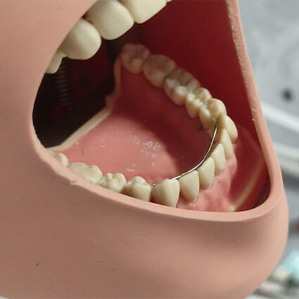mannequin with dental splint