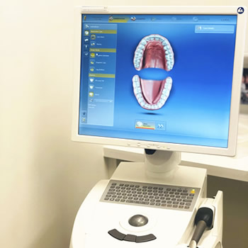 CEREC machine