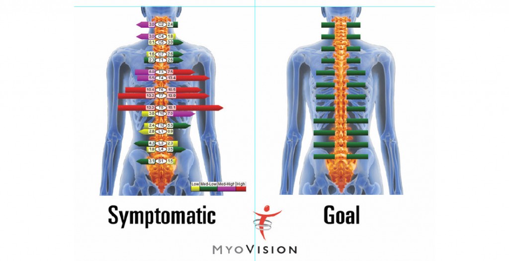 Back and Neck Spine Assessment Surrey, BC