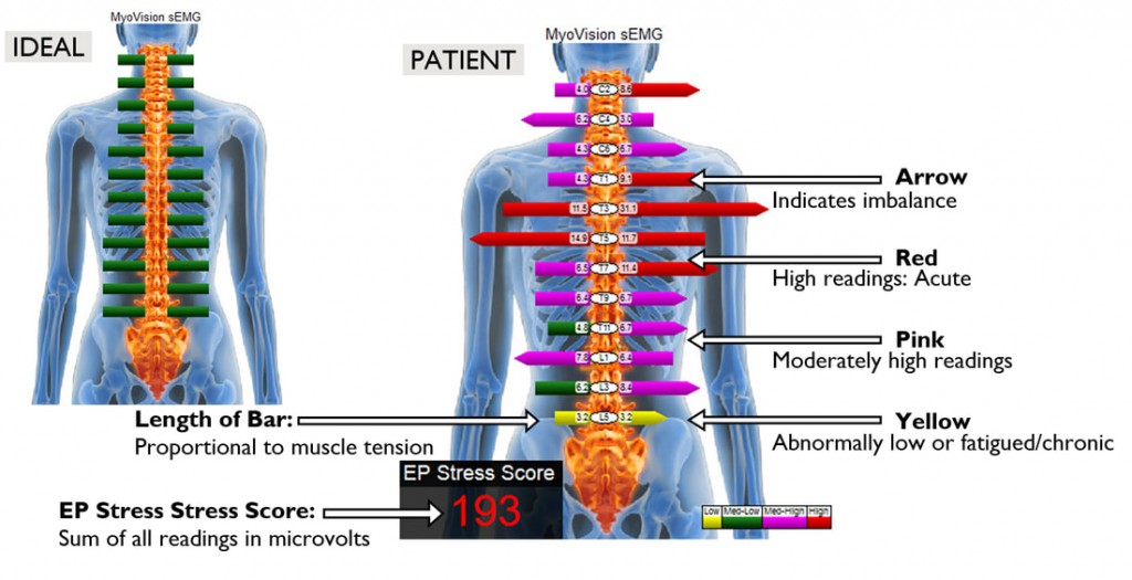 Ideal-Patient-Myovision