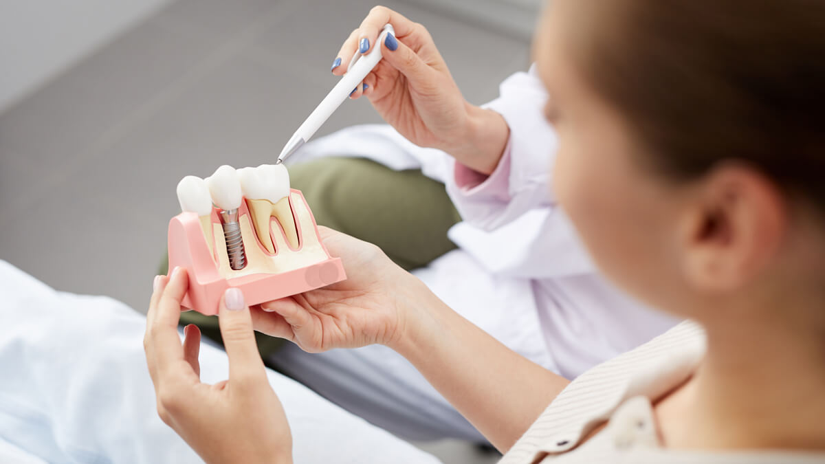 model of dental implants