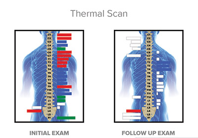 thermal scan graphic