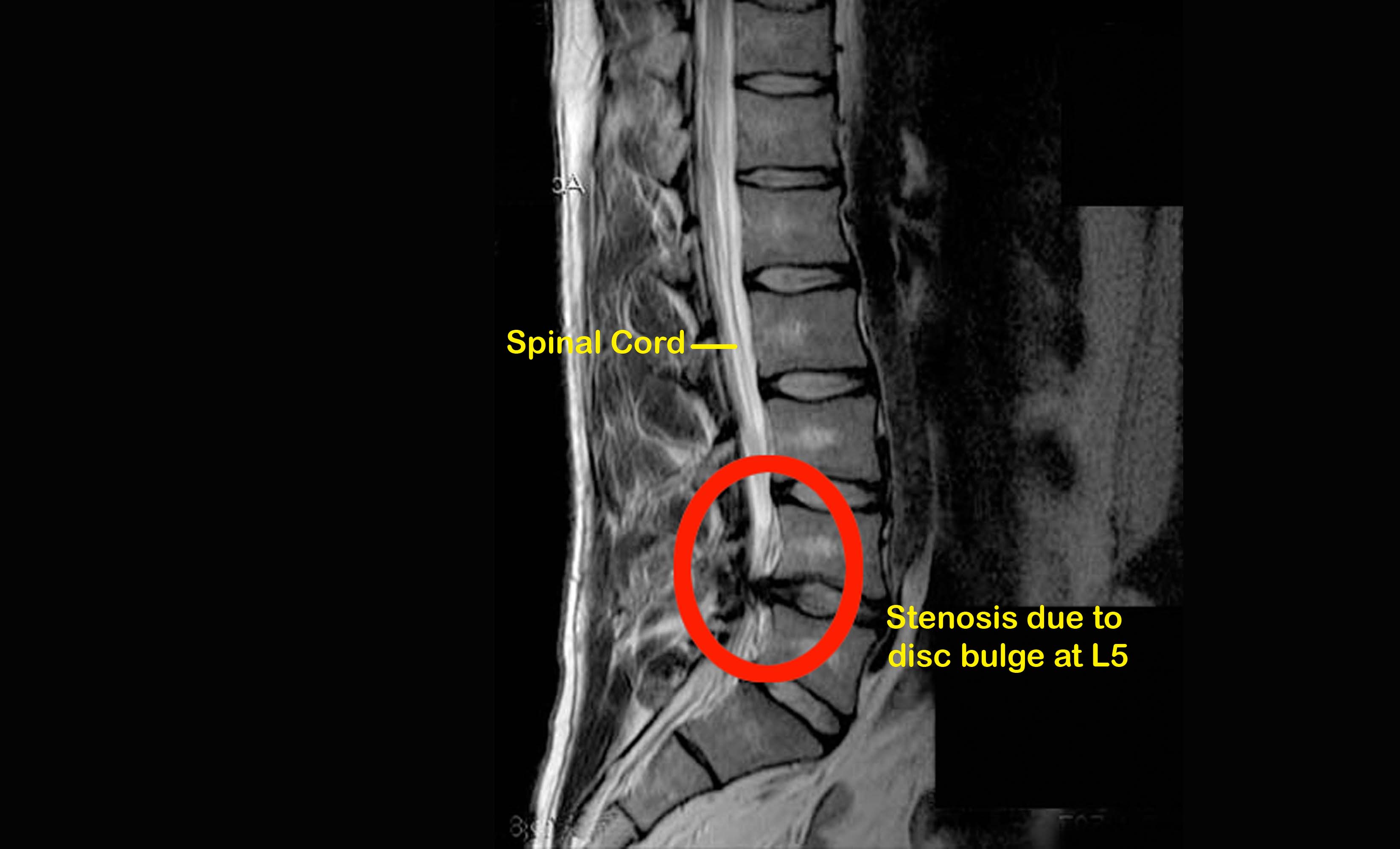 What Triggers Sciatic Nerve Pain? And What You Can Do About It!